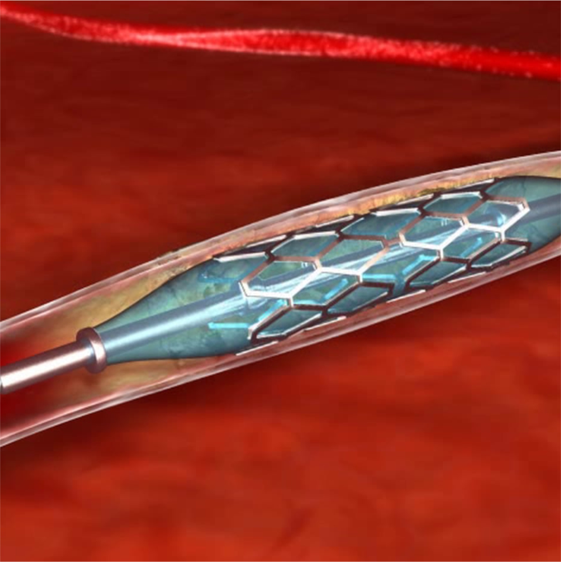 Materials for Medical Devices Arnold Technologies